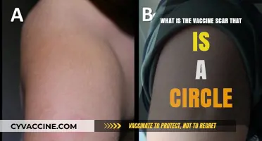 Understanding the Circular Vaccine Scar: Its Meaning and History