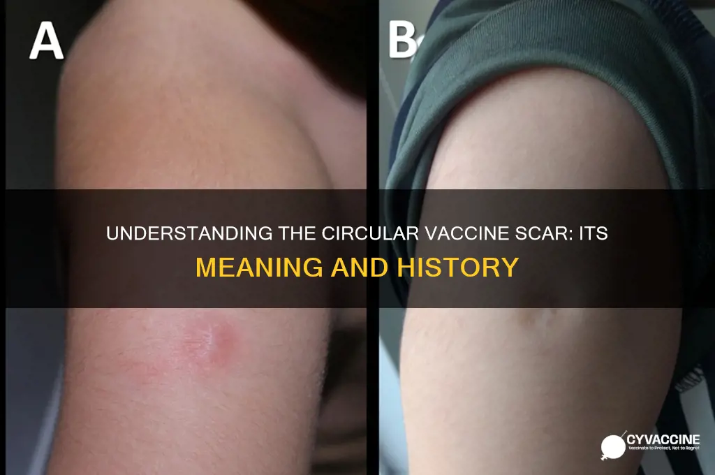 what is the vaccine scar that is a circle