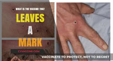 The Smallpox Vaccine's Unique Circular Scar: A Lasting Mark Explained