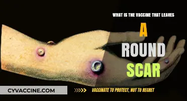 The Round Scar Vaccine: Unveiling the Smallpox Inoculation Legacy
