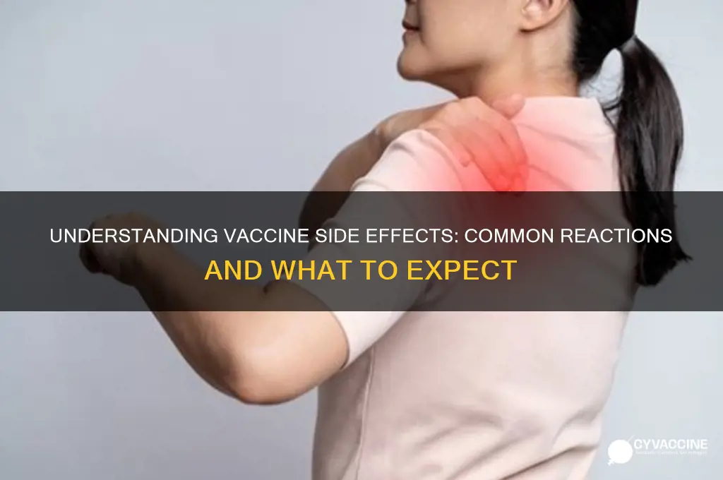 what kind of side affects does vaccines have
