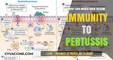 Labs Detecting Pertussis Vaccine Immunity: Key Tests Explained