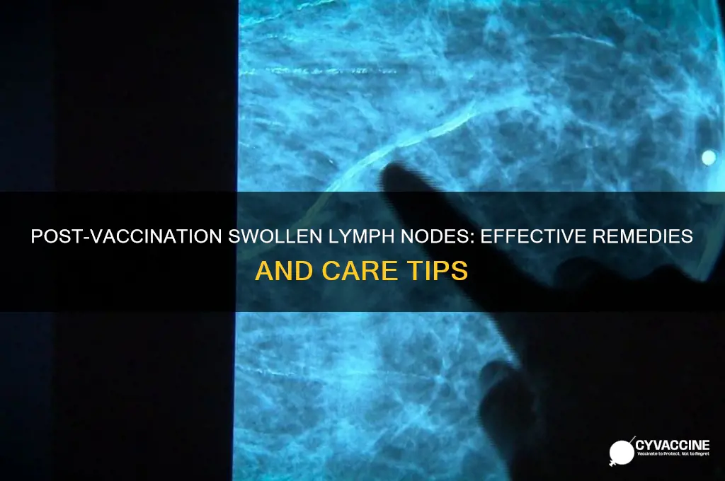 what to do for swollen lymph nodes after vaccination