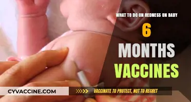Soothing Baby's Vaccine Redness: Gentle Care Tips for 6-Month-Olds