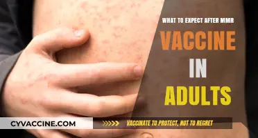 MMR Vaccine Side Effects: What Adults Should Expect Post-Shot