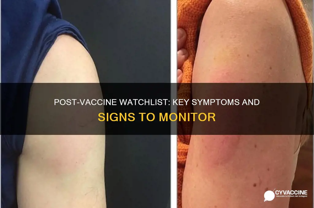 what to keep an eye out for after vaccine