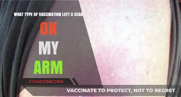 The Smallpox Vaccine Scar: A Mark of Protection and History