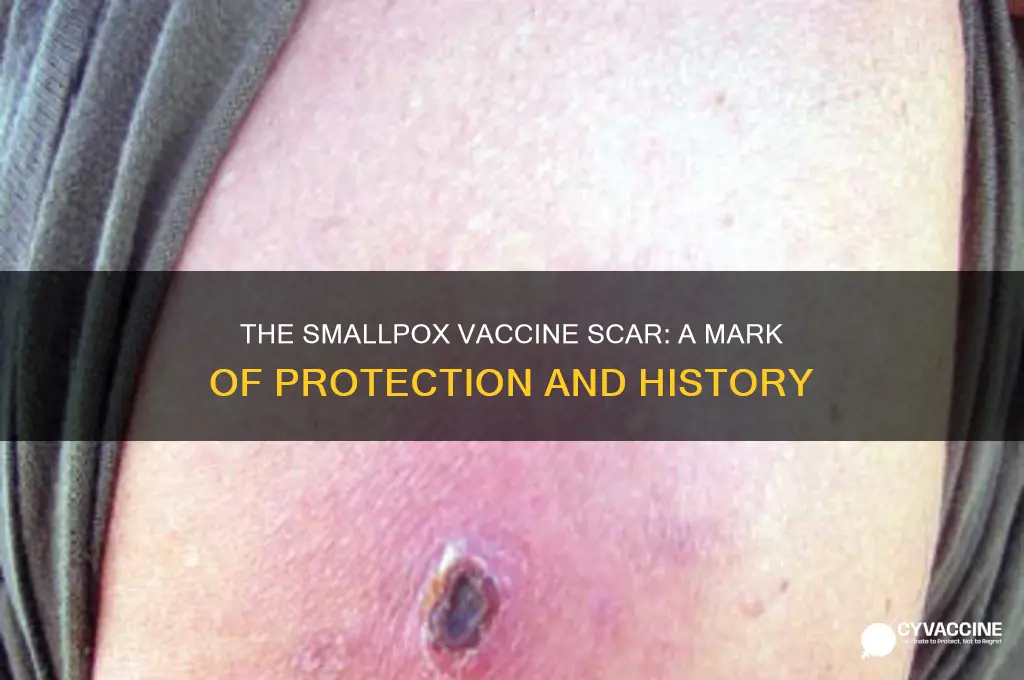 what type of vaccination left a scar on my arm