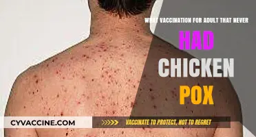 Essential Chickenpox Vaccination Guide for Adults Who Never Had It