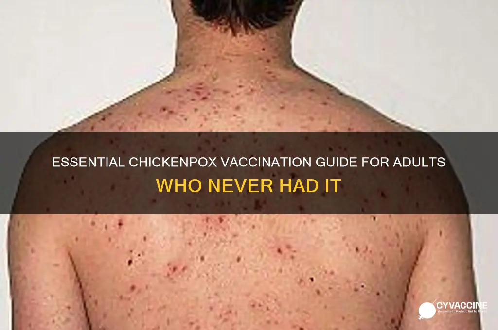 what vaccination for adult that never had chicken pox