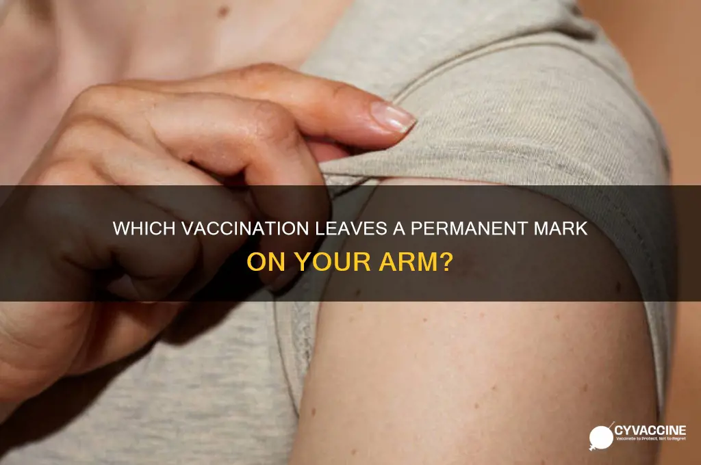 what vaccination leaves a mark on your arm
