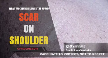 The Round Scar on Your Shoulder: Which Vaccination Causes It?
