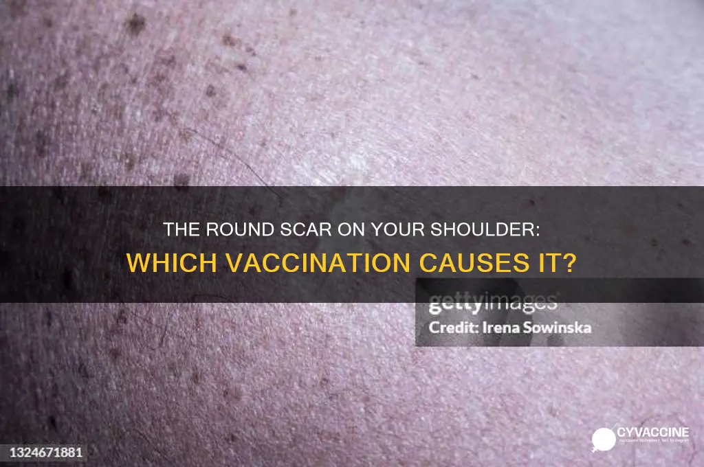 what vaccination leaves the round scar on shoulder