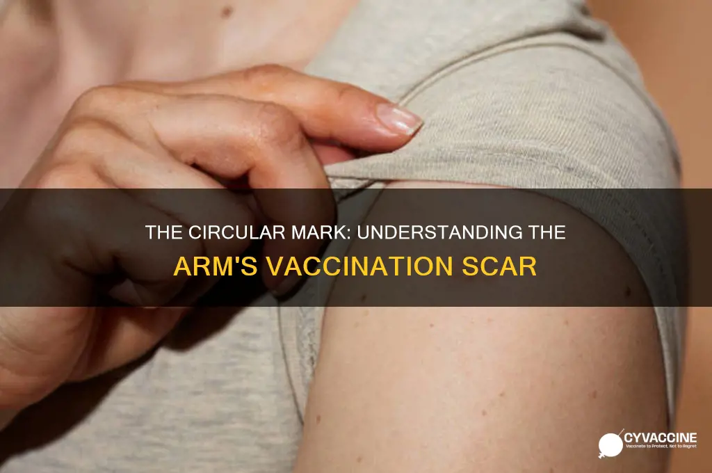 what vaccination left a circle on your arm