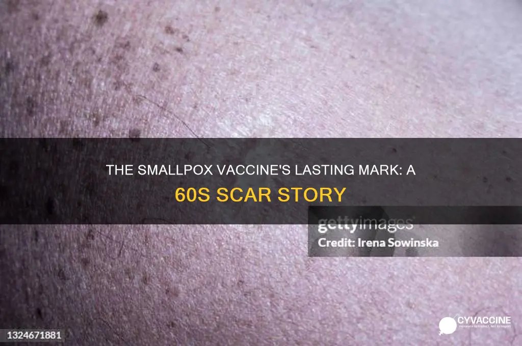 what vaccination left a scar in the 60