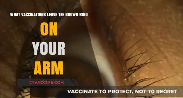 Vaccination Marks Explained: Why Some Shots Leave Brown Rings on Arms