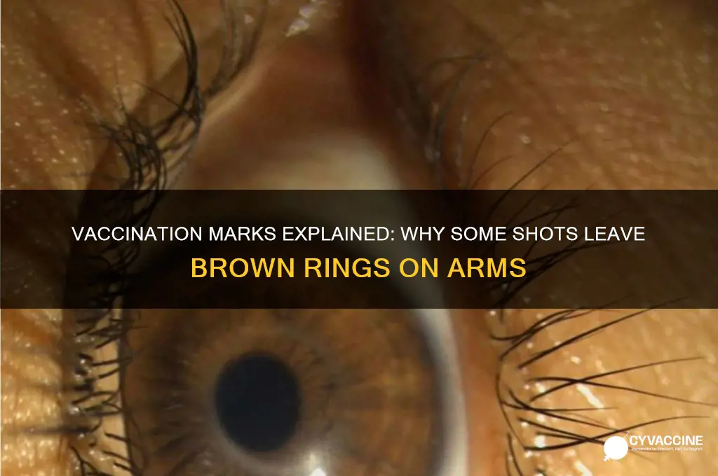 what vaccinations leave the brown ring on your arm