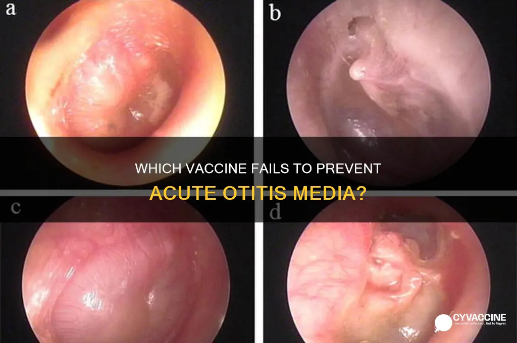 what vaccine does not help prevent acute otitis media