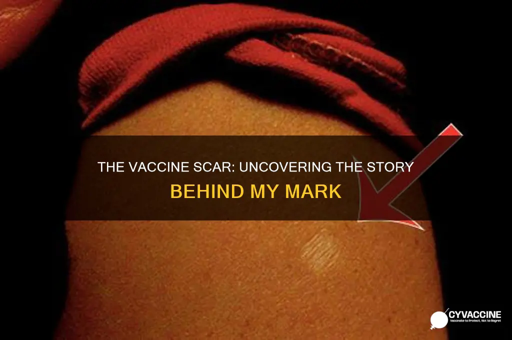 what vaccine gave me a scar