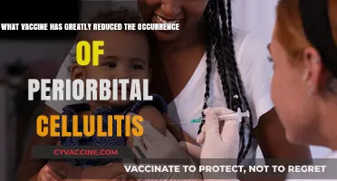 How the Hib Vaccine Dramatically Reduced Periorbital Cellulitis Cases