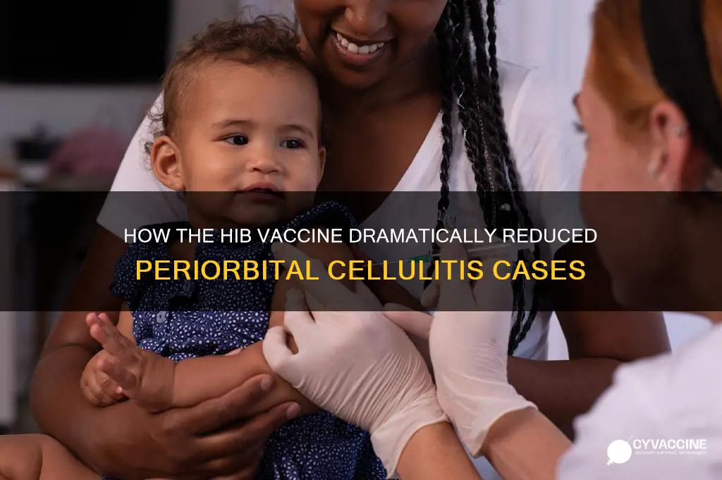 what vaccine has greatly reduced the occurrence of periorbital cellulitis