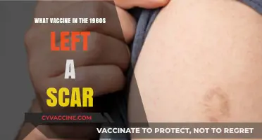 The Smallpox Vaccine's Lasting Mark: 1960s Scars Explained
