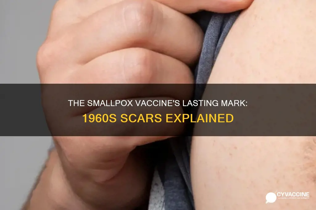 what vaccine in the 1960s left a scar