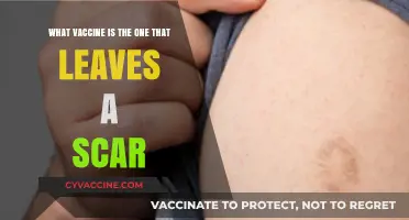 The Smallpox Vaccine: Why It Leaves a Unique Scar