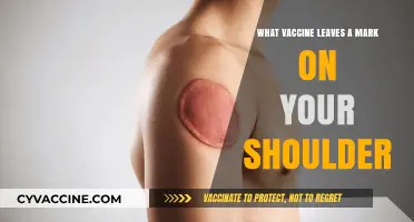 Which Vaccine Leaves a Circular Mark on Your Shoulder?