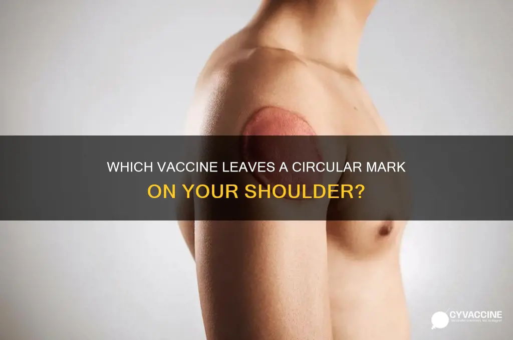 what vaccine leaves a mark on your shoulder