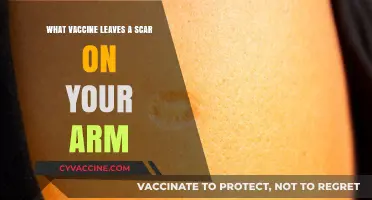 Vaccine Scars: Why Some Vaccines Leave Marks