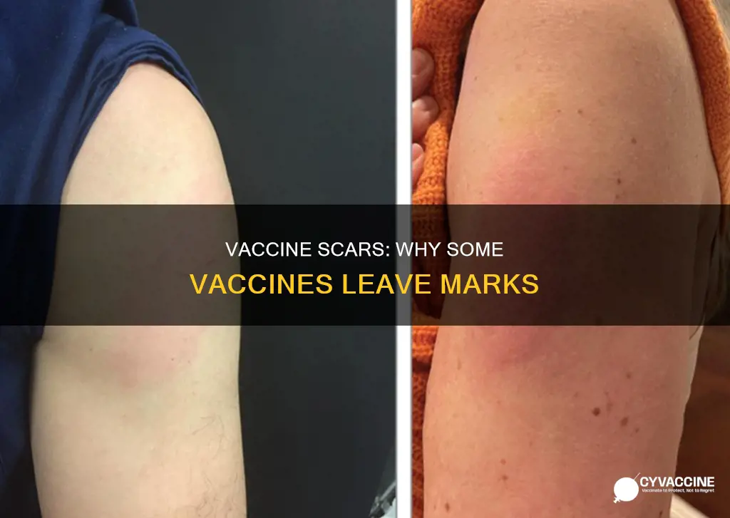 what vaccine leaves a scar on your arm