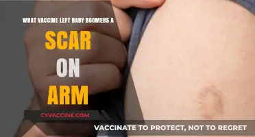 The Smallpox Vaccine: Why Baby Boomers Bear a Unique Arm Scar