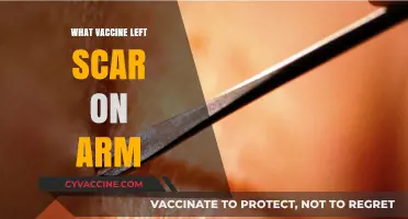 The Smallpox Vaccine: Why It Left a Lasting Scar on Arms