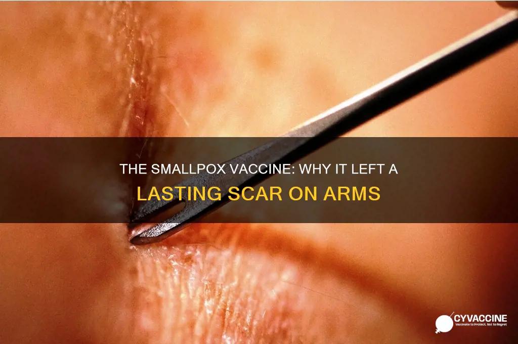 what vaccine left scar on arm