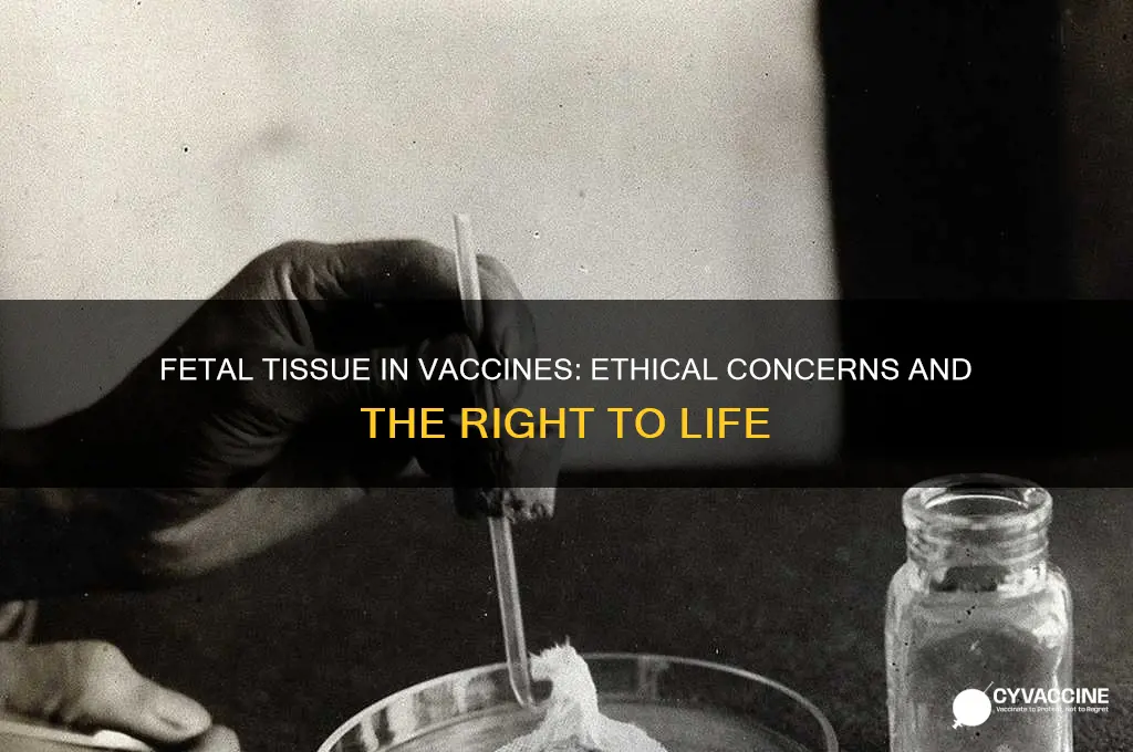 what vaccines are made from fetus right to life