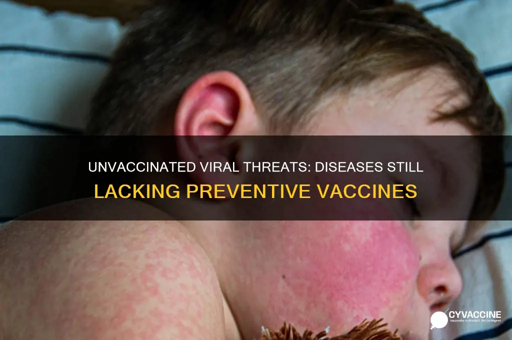 what viral diseas do we not vaccinate against