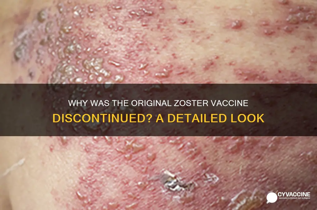 what was teh zoster vaccine that was discontinued