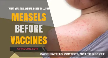 Measles Mortality: Pre-Vaccine Era Annual Death Toll Revealed