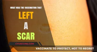 Vaccination Scar: A Mark of Protection