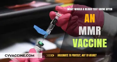 Post-MMR Vaccine Blood Test: What Results Can You Expect?