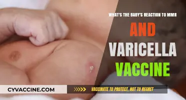 Baby's Response to MMR and Varicella Vaccines: What to Expect