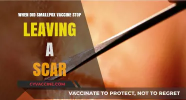 Smallpox Vaccine Scar: When Did It Stop Leaving a Mark?