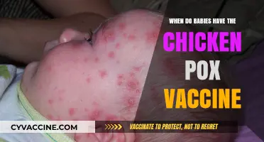 When Should Babies Get the Chickenpox Vaccine: A Parent's Guide
