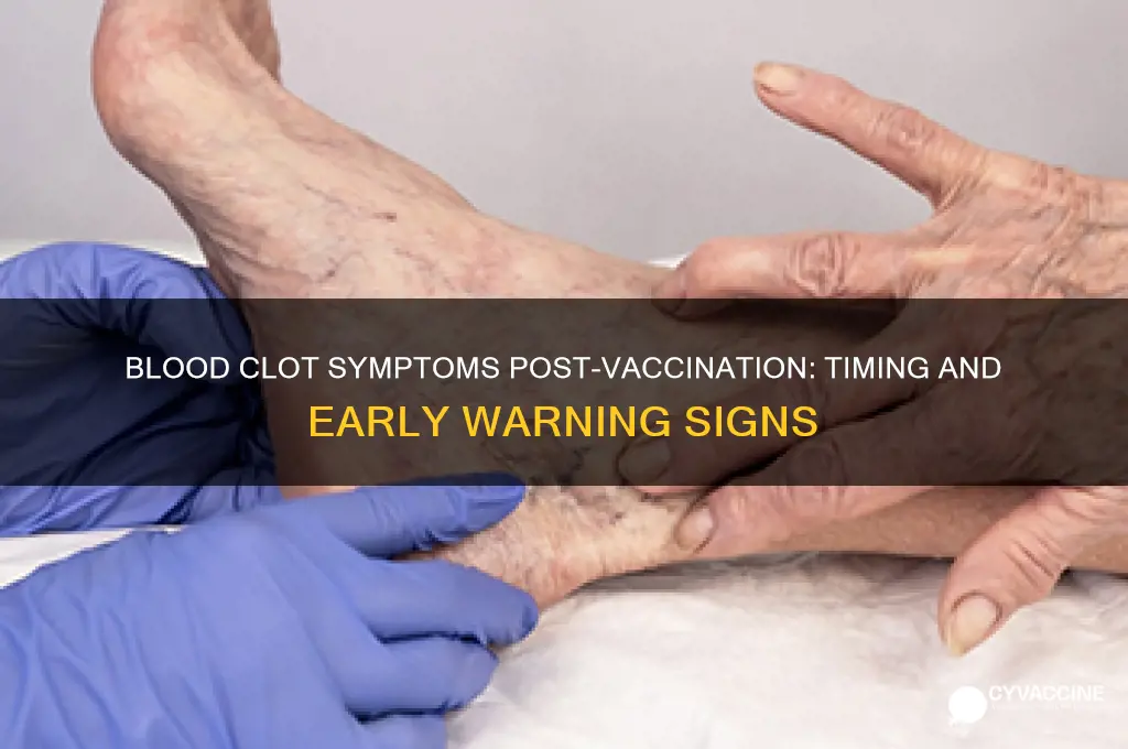 when do blood clot symptoms start after vaccination