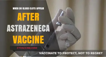 AstraZeneca Vaccine and Blood Clots: Timing, Risks, and Symptoms Explained