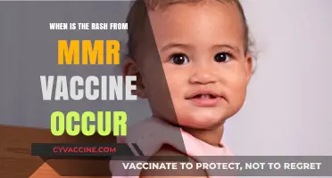 MMR Vaccine Rash: Timing, Symptoms, and What to Expect