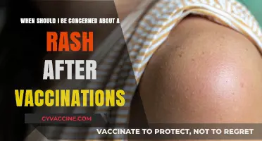 Post-Vaccination Rashes: When to Seek Medical Attention and Why