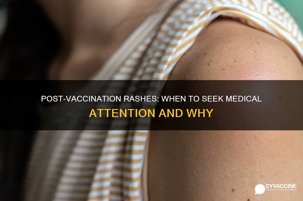when should i be concerned about a rash after vaccinations