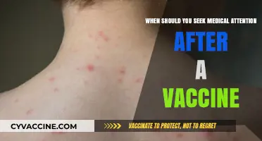 Post-Vaccine Symptoms: When to Seek Medical Attention for Your Health